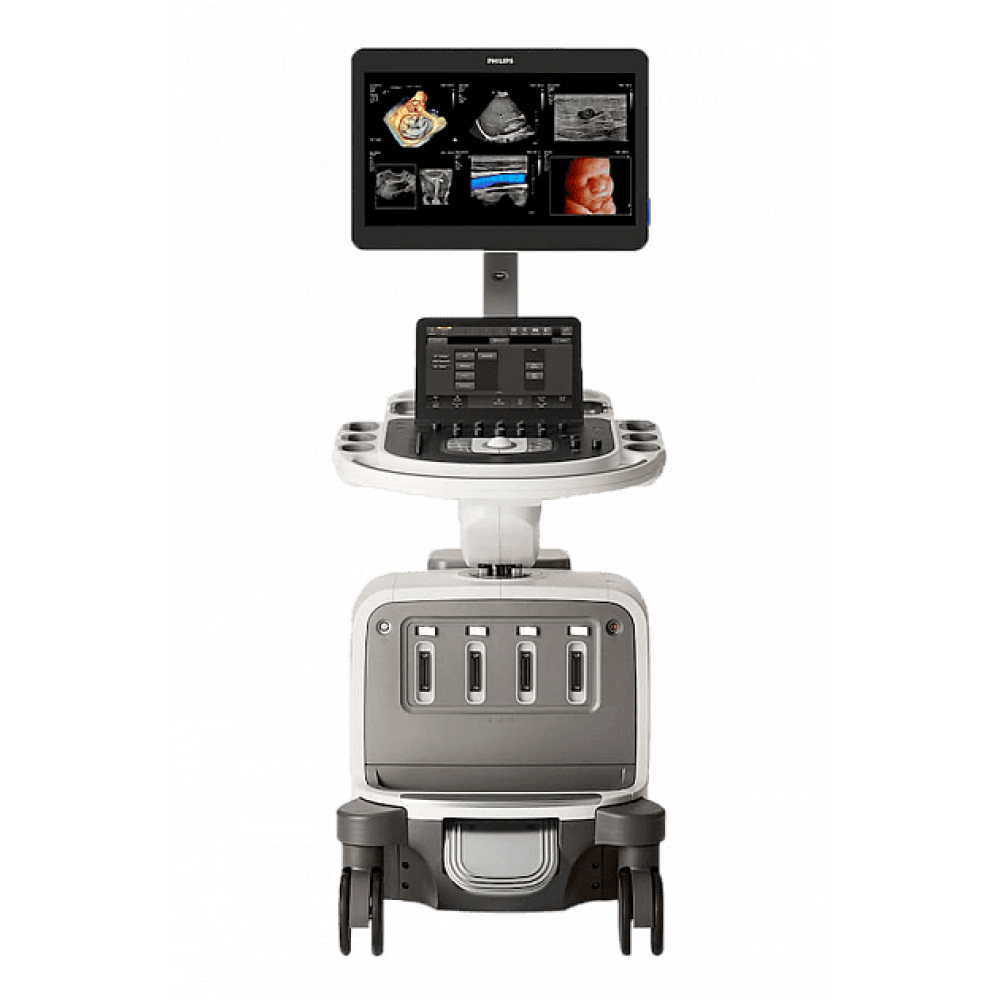 Премиальная ультразвуковая система Philips EPIQ Elite