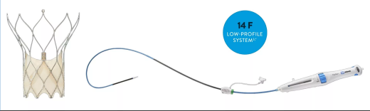 Система транскатетерной имплантации аортального клапана Abbot  PORTICO с системой доставки FLEXNAV