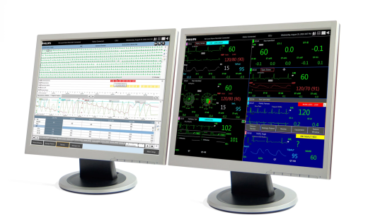 Центральная станция мониторинга Philips IntelliVue iX