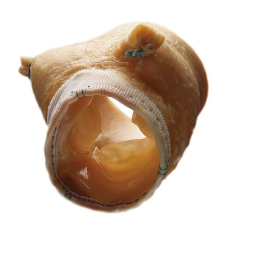 Биопротез аортального клапана Medtronic Freestyle 